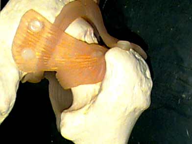 Colis Douleurs Articulaires